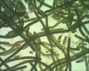 Cyanobacteria, microimage by Holly Harris